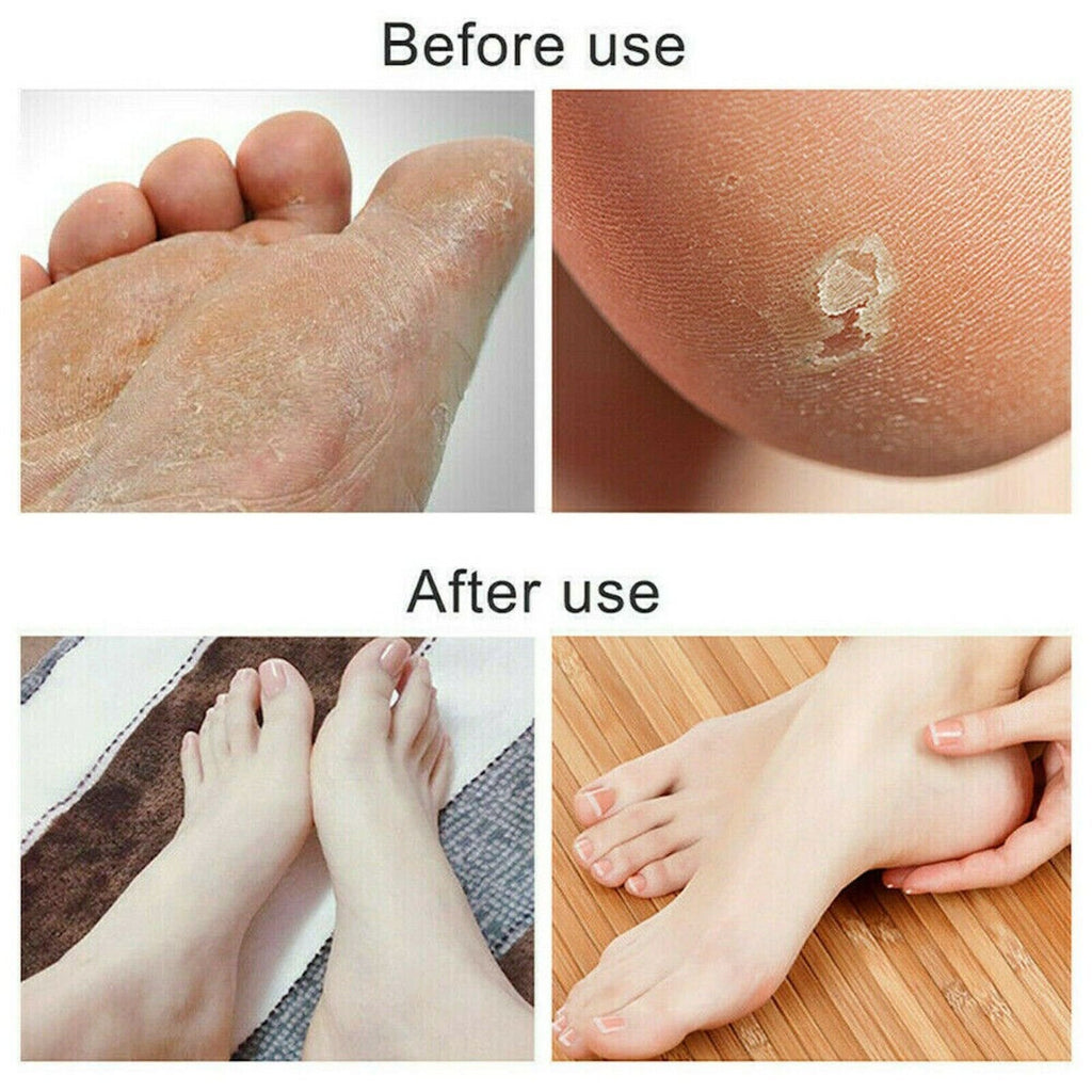 Foot File Scraper Rasp Hard Dead Dry Skin Remover Grater Callus Pedicure Black image 7