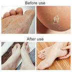 Foot File Scraper Rasp Hard Dead Dry Skin Remover Grater Callus Pedicure Black image 7
