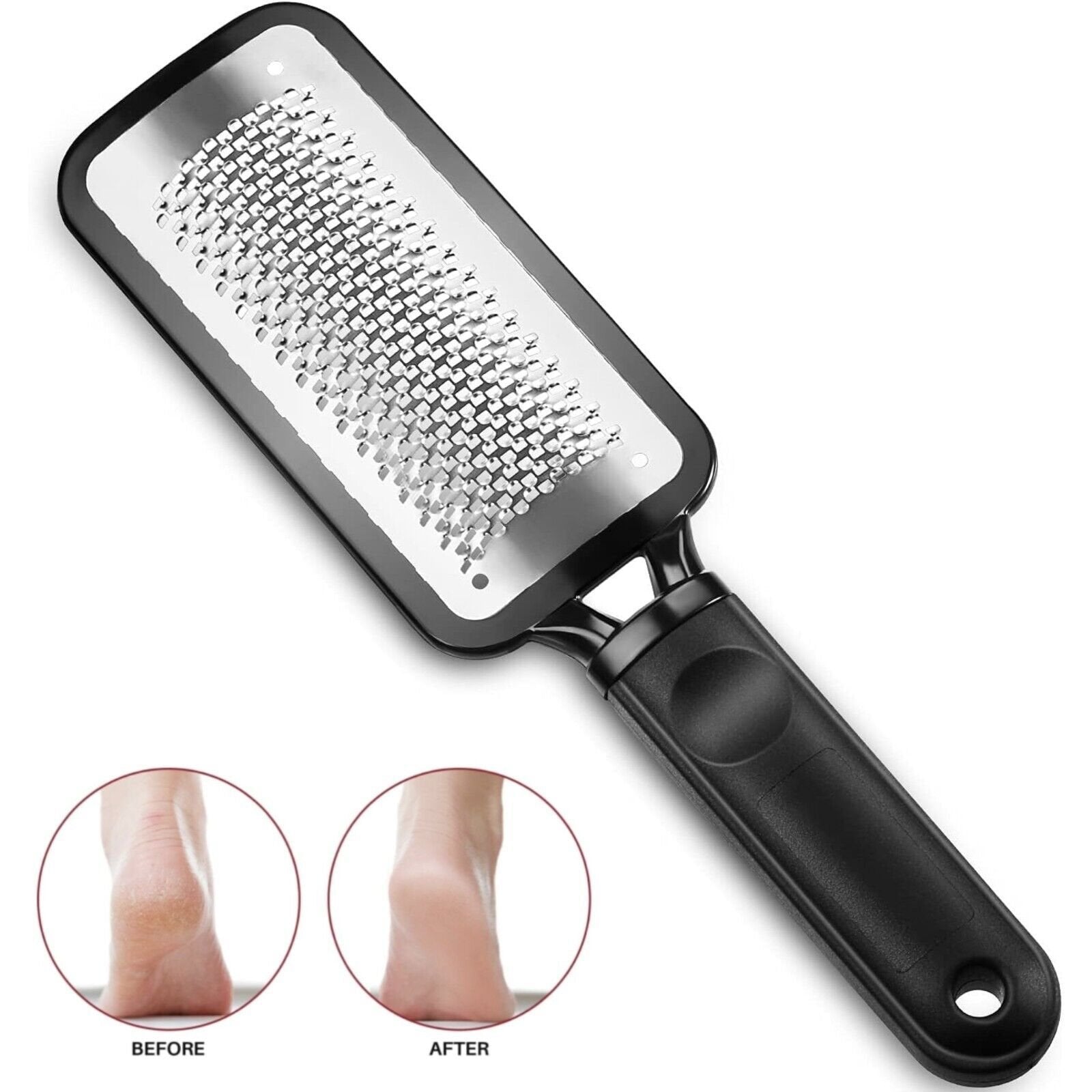 Foot File Scraper Rasp Hard Dead Dry Skin Remover Grater Callus Pedicure Black image 2